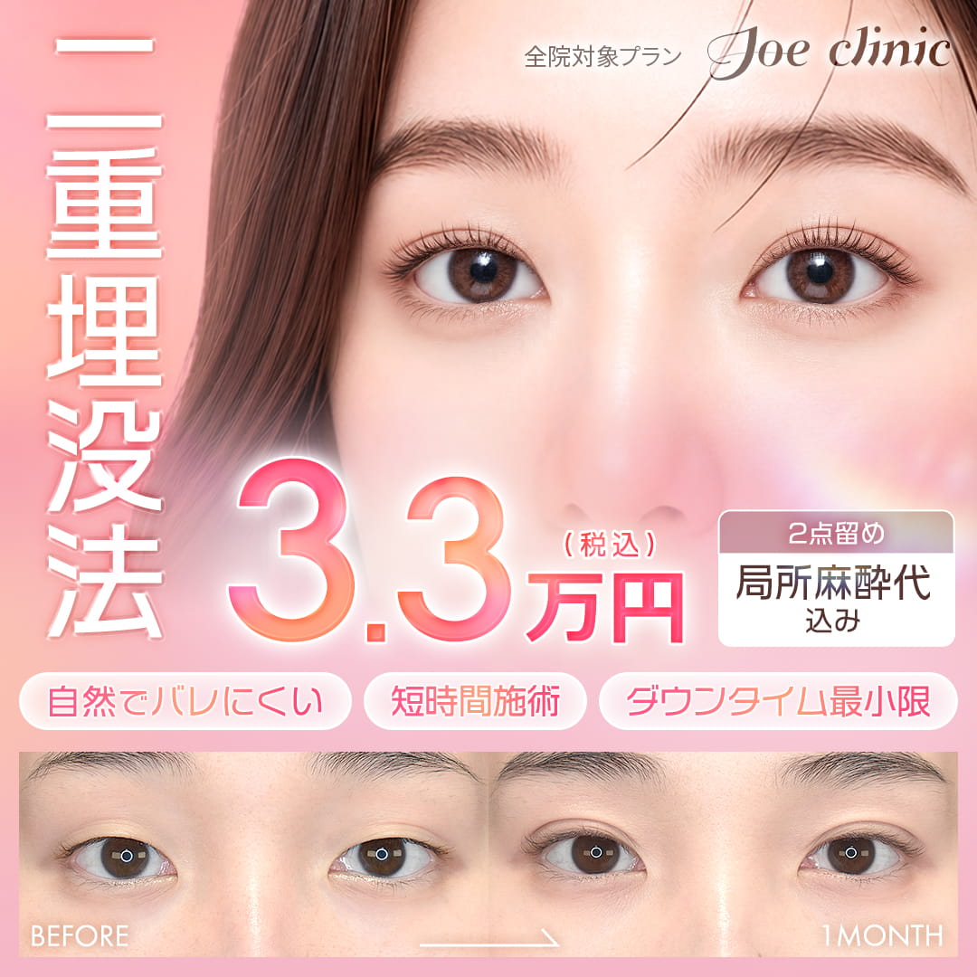 二重埋没法 全院対象プラン