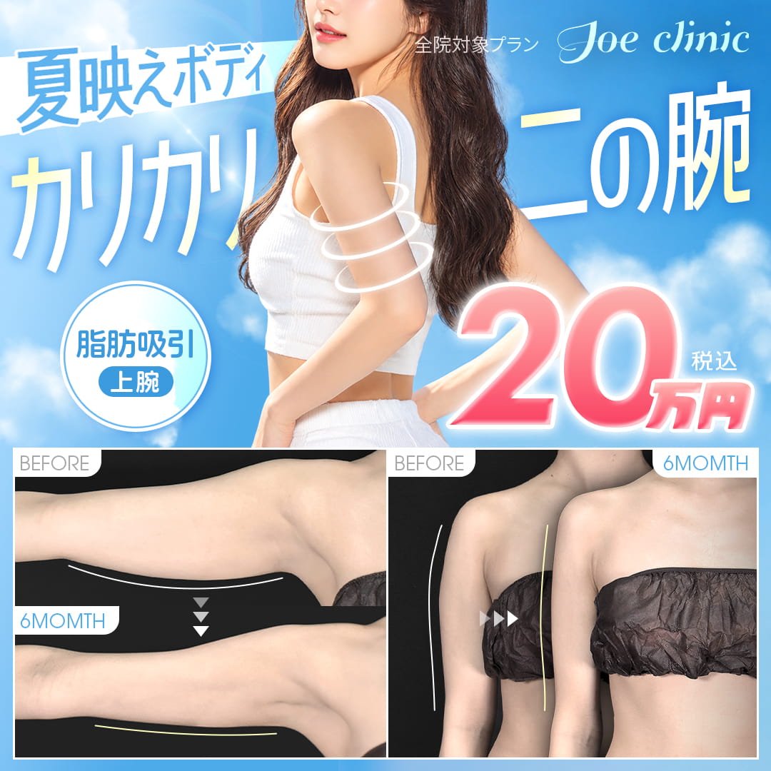二の腕脂肪吸引 カリカリ二の腕 全院対象プラン