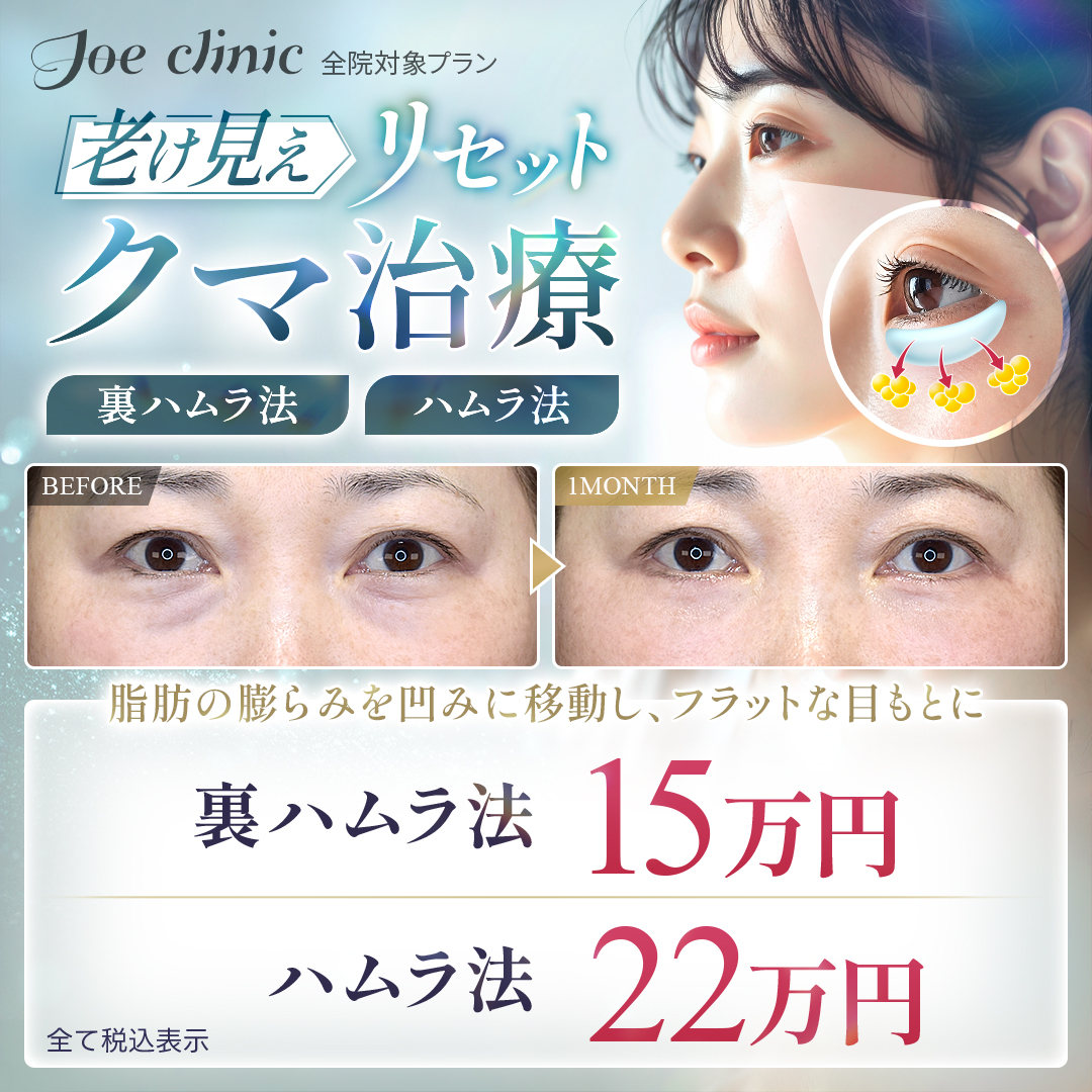 裏ハムラ法・ハムラ法 全院対象プラン