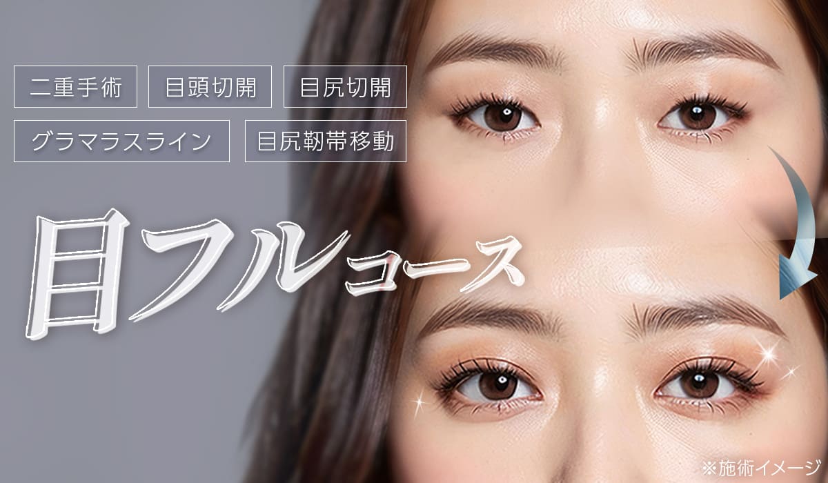 目フルコース(バンビ目整形・アーモンドアイ)