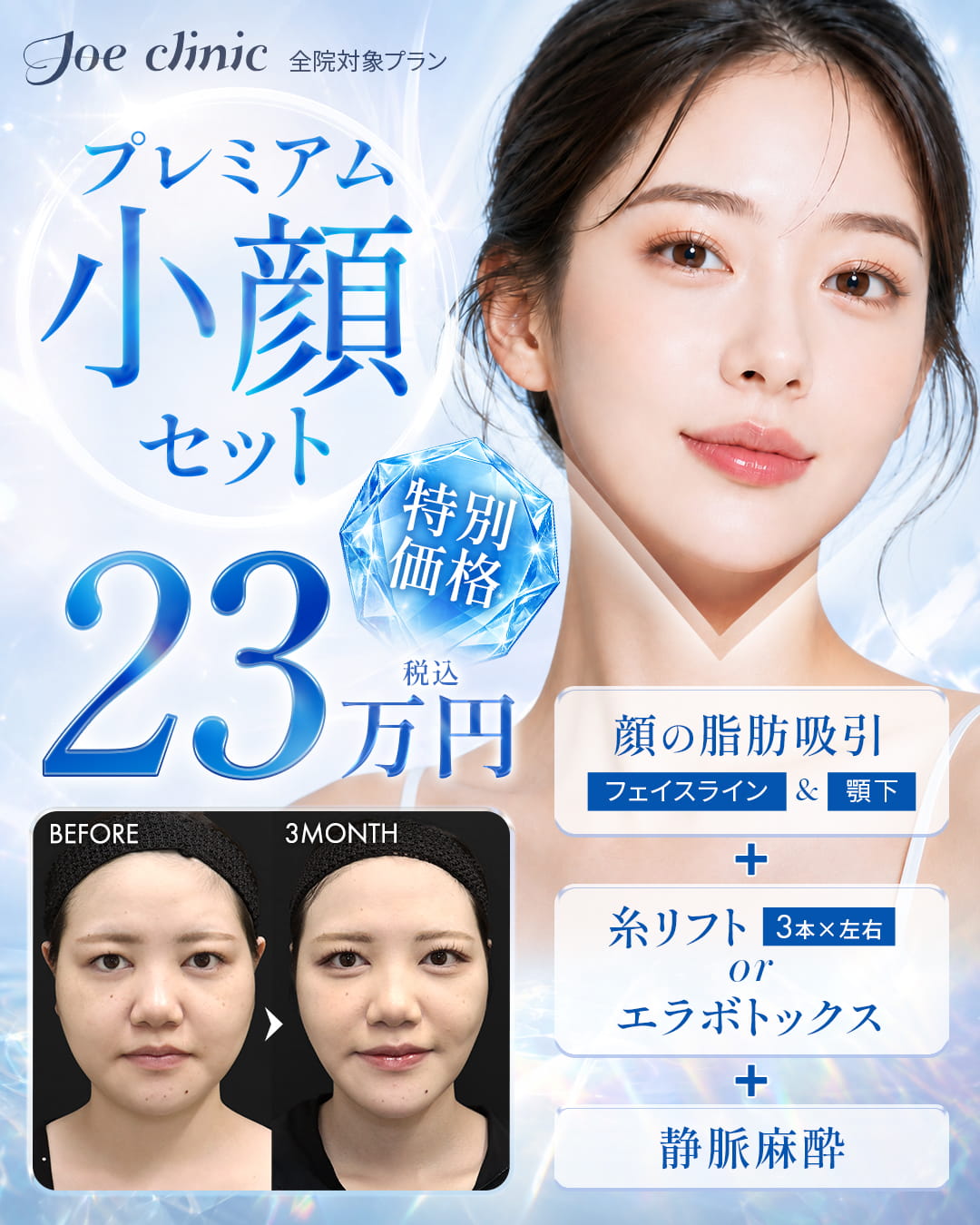 プレミアム小顔コース 全院対象プラン